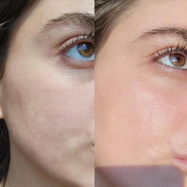 Eco Sonya Serum Of Clear 30ml