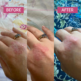 MooGoo Pink Eczema Cream 120g