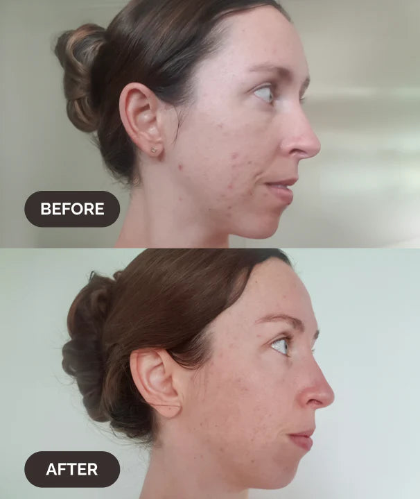 La Mav Bakuchiol 4% Natural Retinol Alternative 30ml